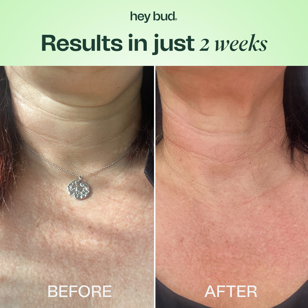 Hey Bud Skincare Facebook ad