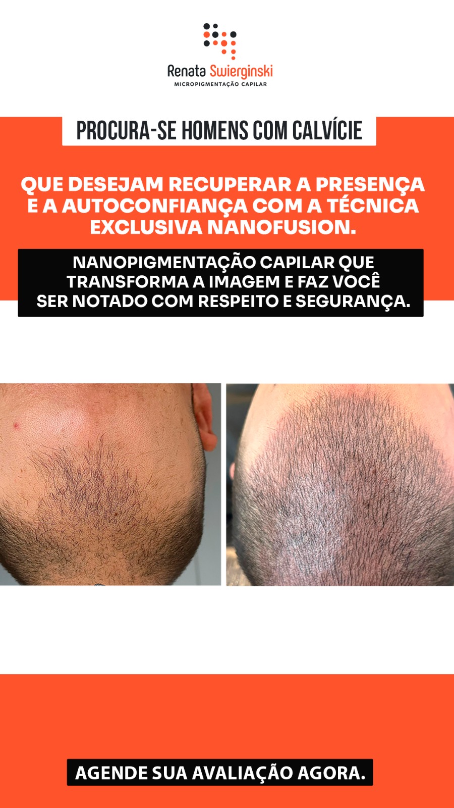 Renata NanoBarber Facebook ad from Apr 7, 2026