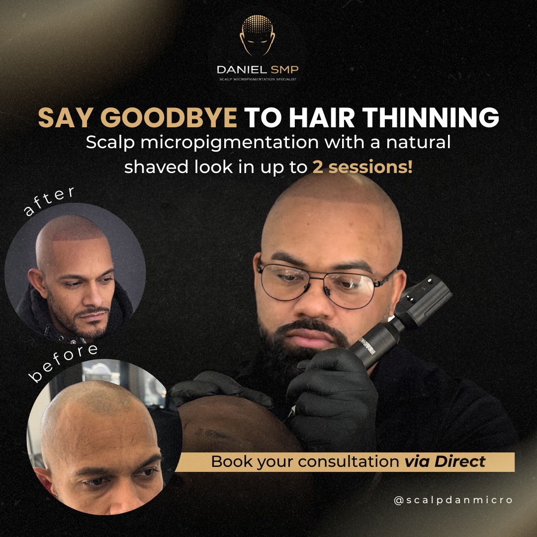 Scalpdanmicro Facebook ad: Está incomodado com falhas no cabelo, entradas ou…