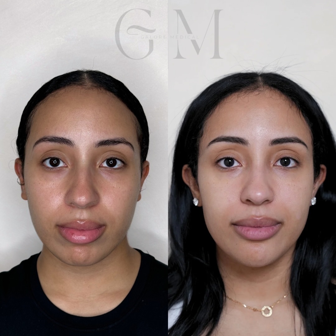galoremedical2 Facebook ad