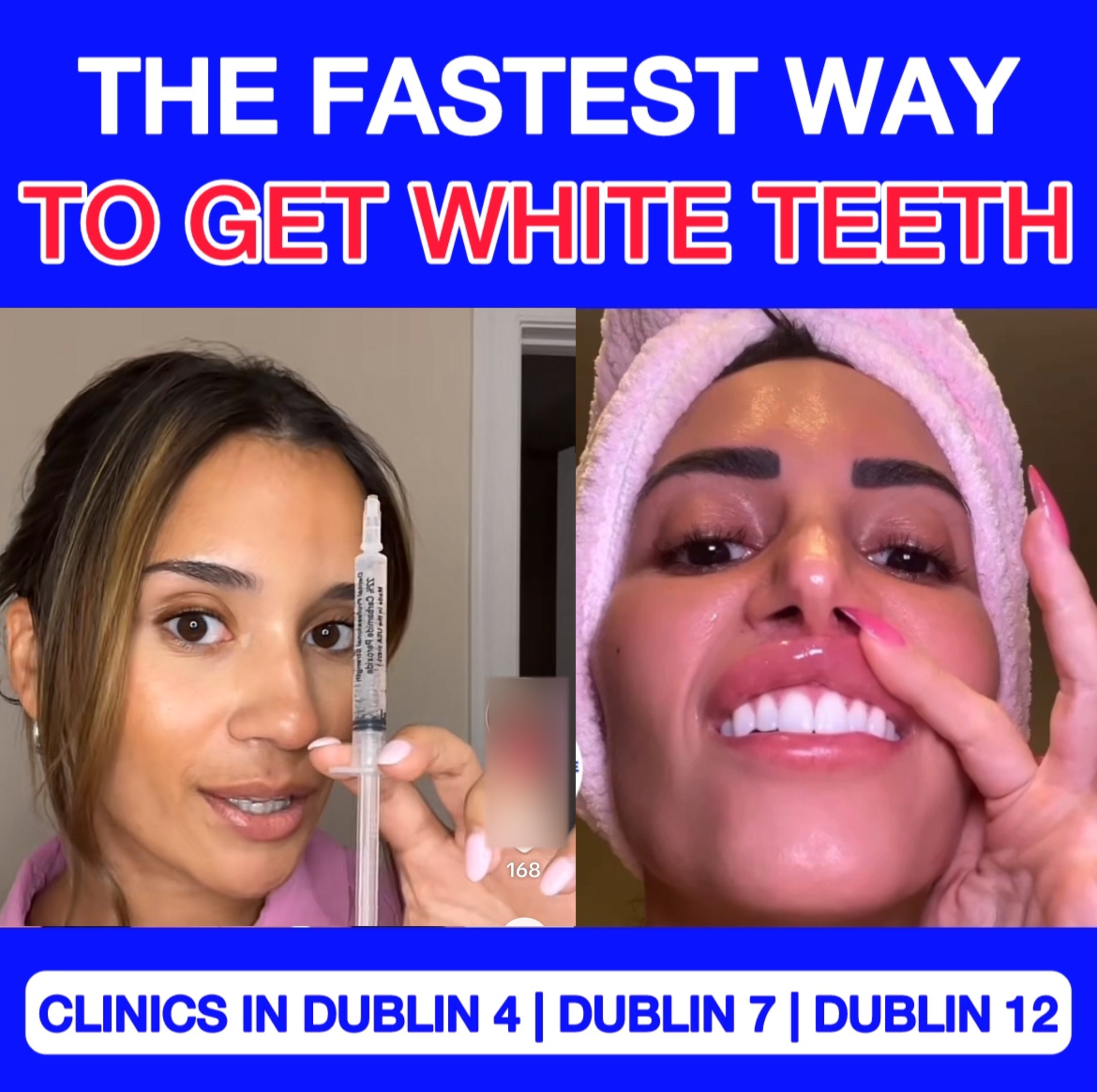 White Smile Facebook ad