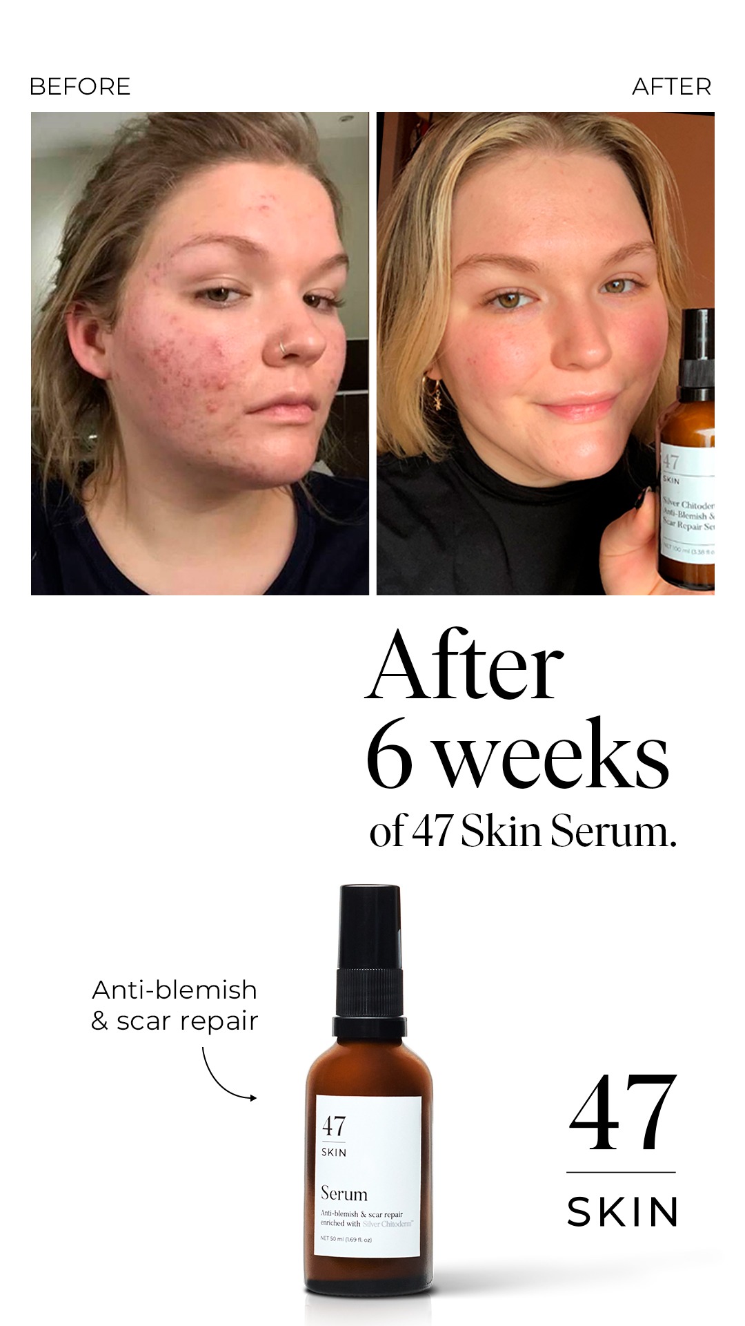 47Skin Facebook ad