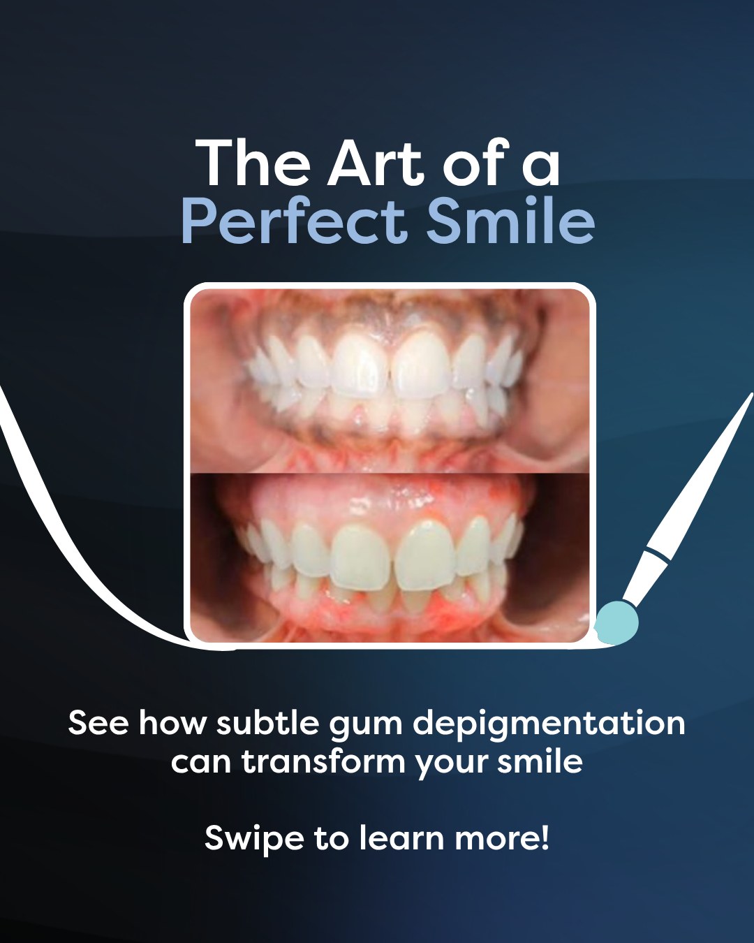 Aspire Dental Wellness Facebook ad: Not all smile transformations are about teeth