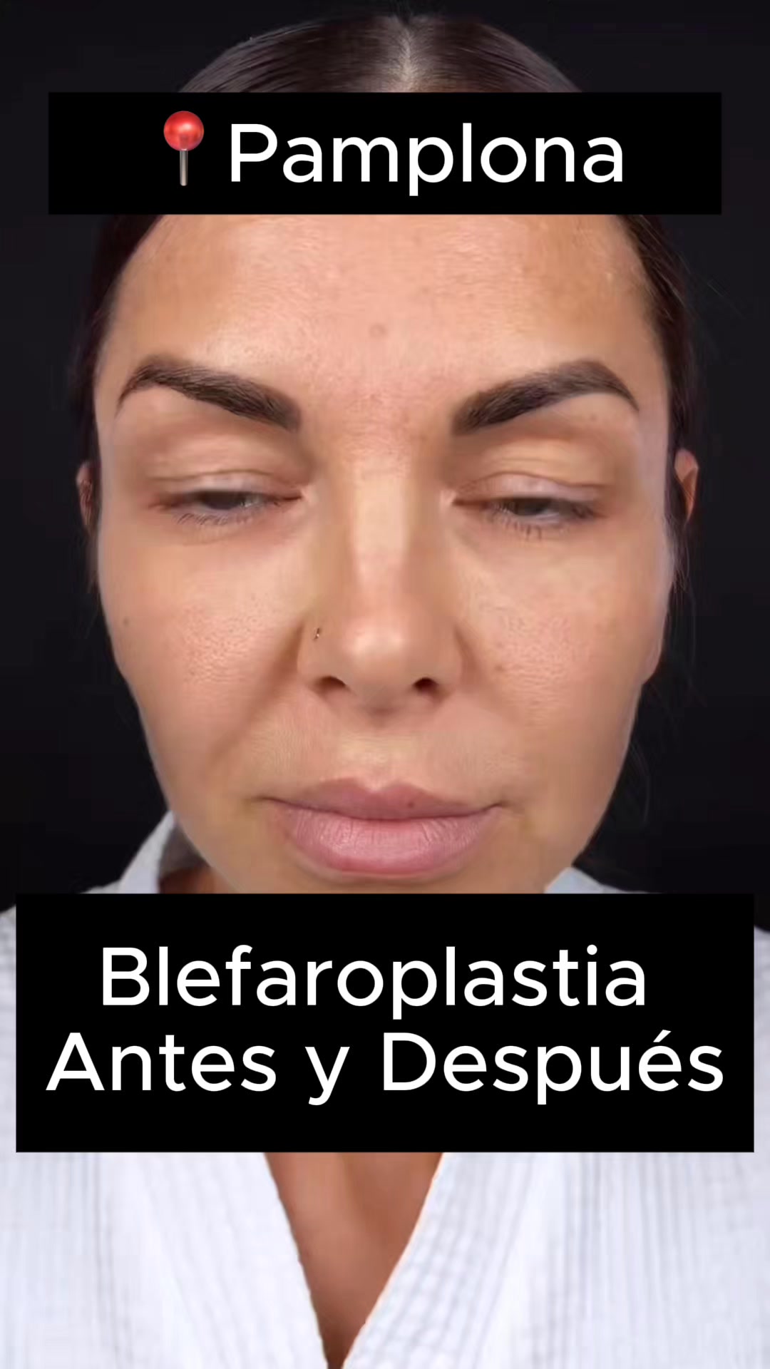 Dr. Alfredo Castro Estética Facial Pamplona Facebook ad: 4.9 Doctoralia.es