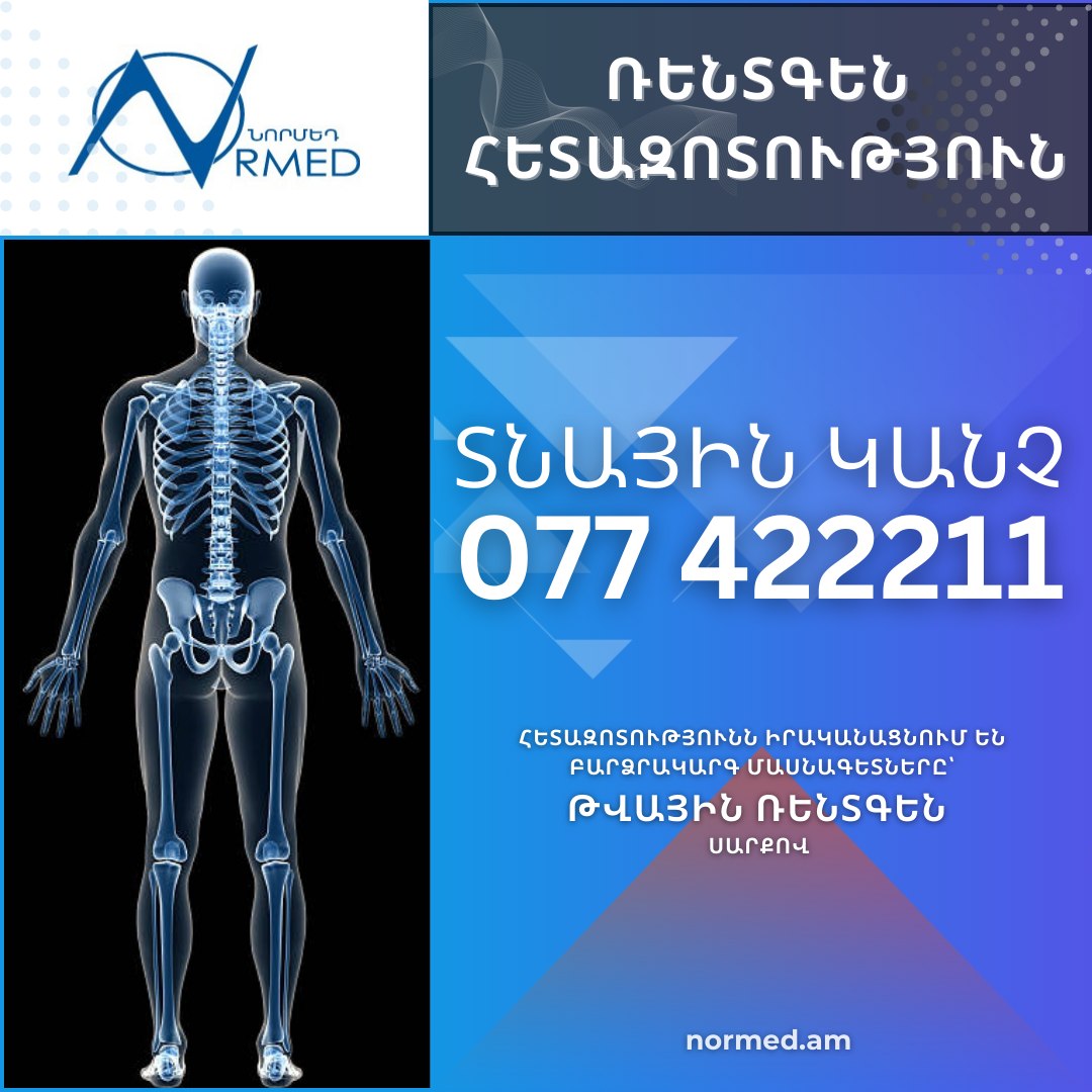 Normed medical center / Նորմեդ բժշկական կենտրոն Facebook ad: «Նորմեդ» բժշկական կենտրոնը, հոգ տանելով պացիենտների և նրանց…