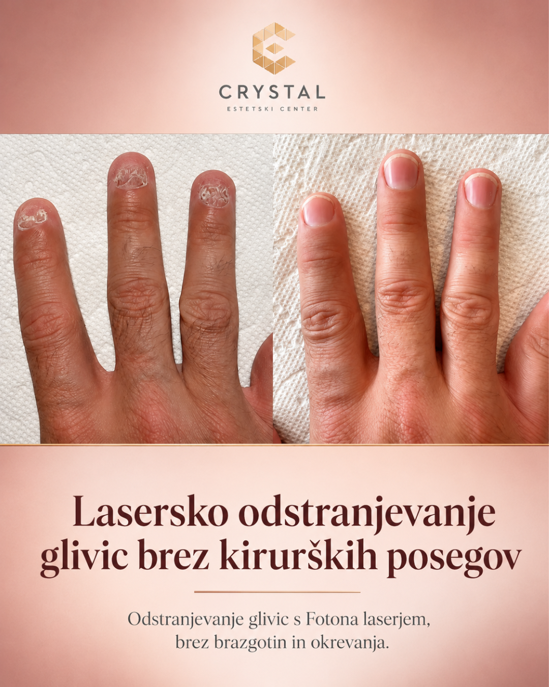 Estetski center Crystal Facebook ad: GLIVICE?