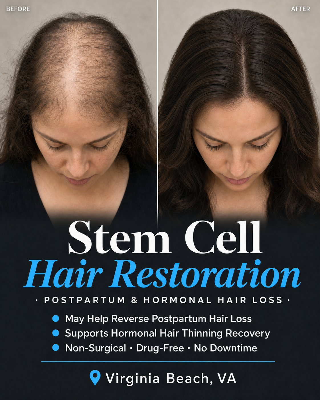 NewLife Regenerative Facebook ad: Thicker, Fuller Hair Without Drugs or Surgery