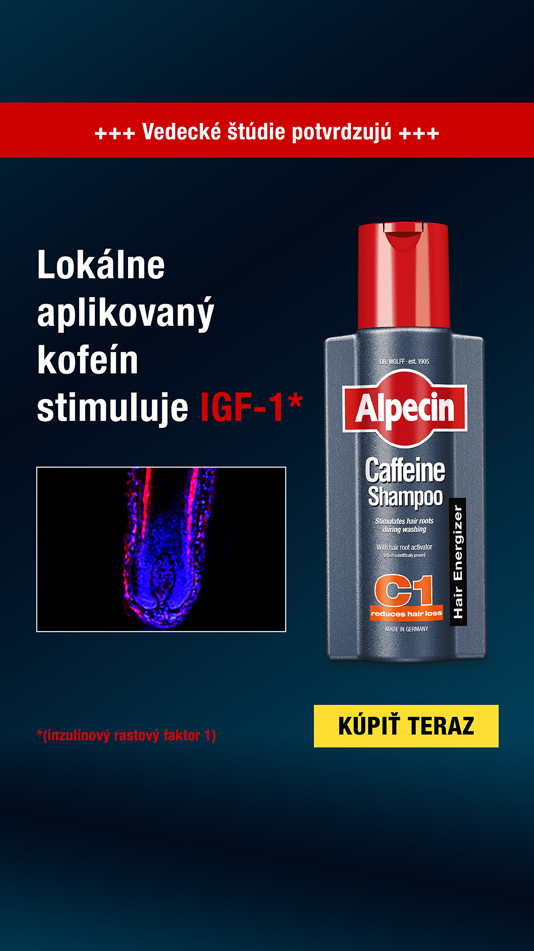 Alpecin Facebook ad from Mar 10, 2026
