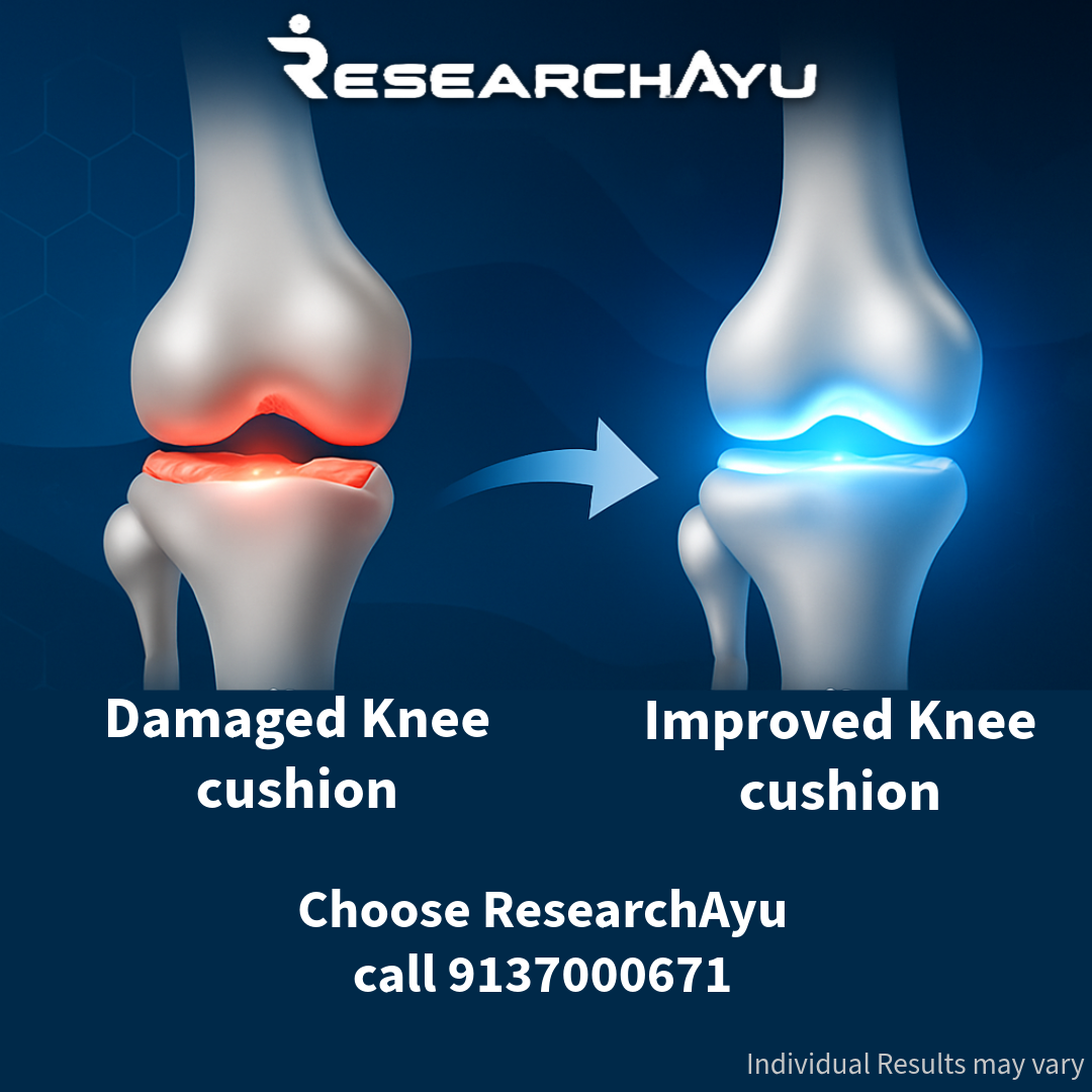 Research Ayu Knee Health Facebook ad