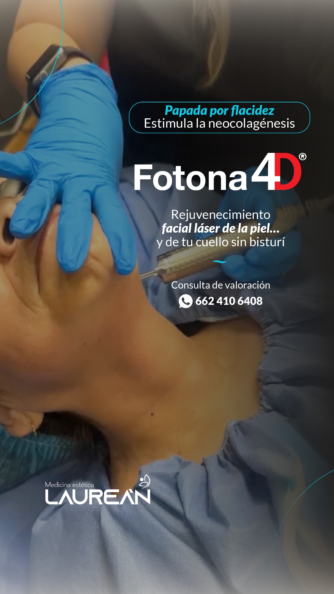 Medicina estética Laurean Facebook ad from Mar 31, 2026