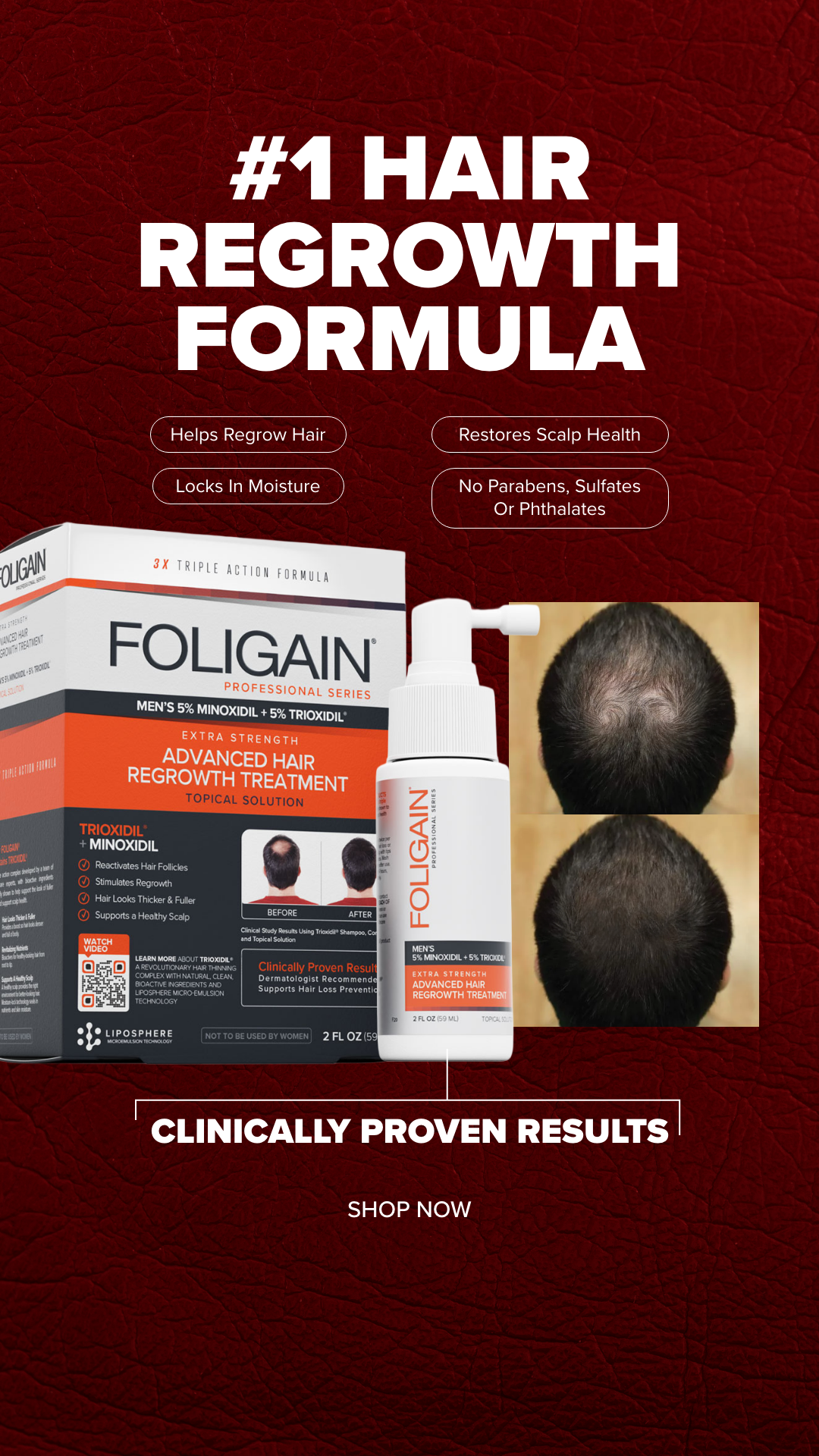 FOLIGAIN Facebook ad