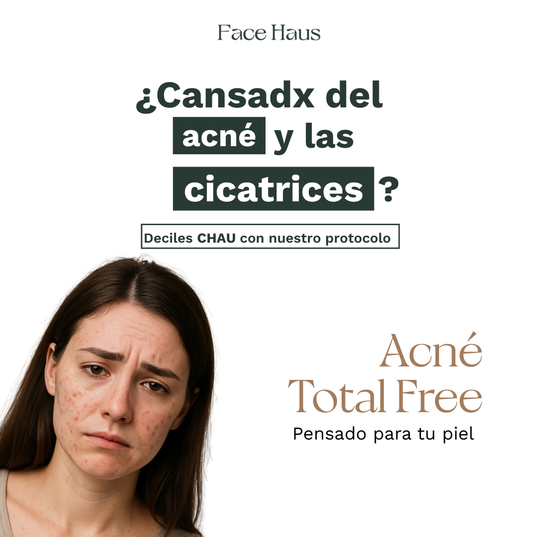 Facehaus.ar Facebook ad from Feb 4, 2026