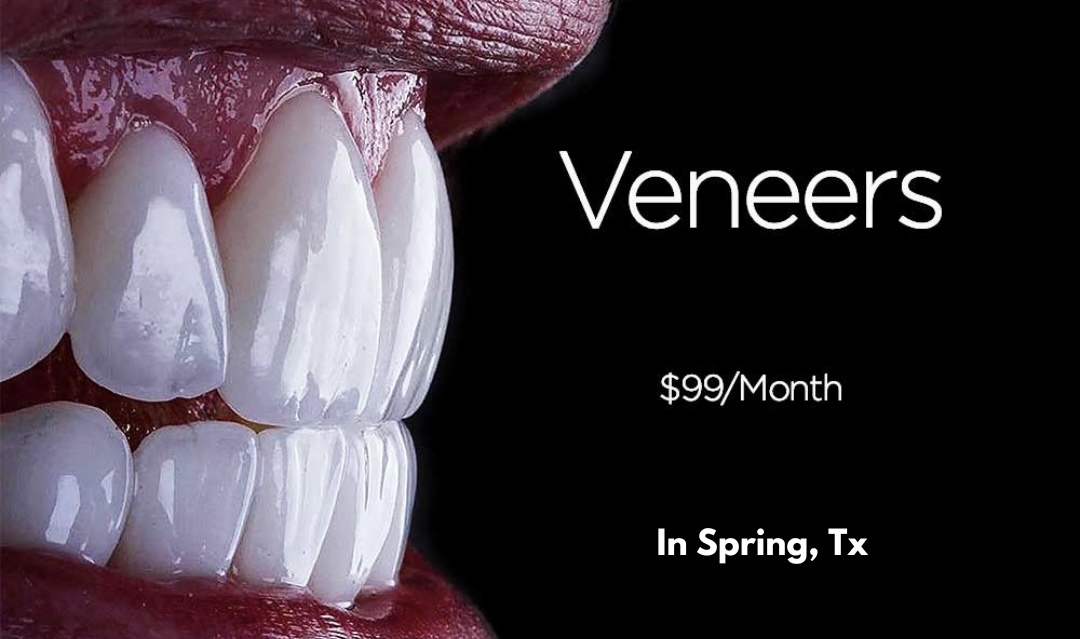Nu Dentistry Facebook ad: Veneers Starting at $99/month