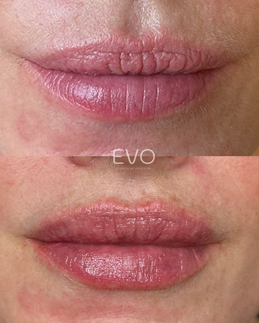 Evoclinic Beloura Facebook ad