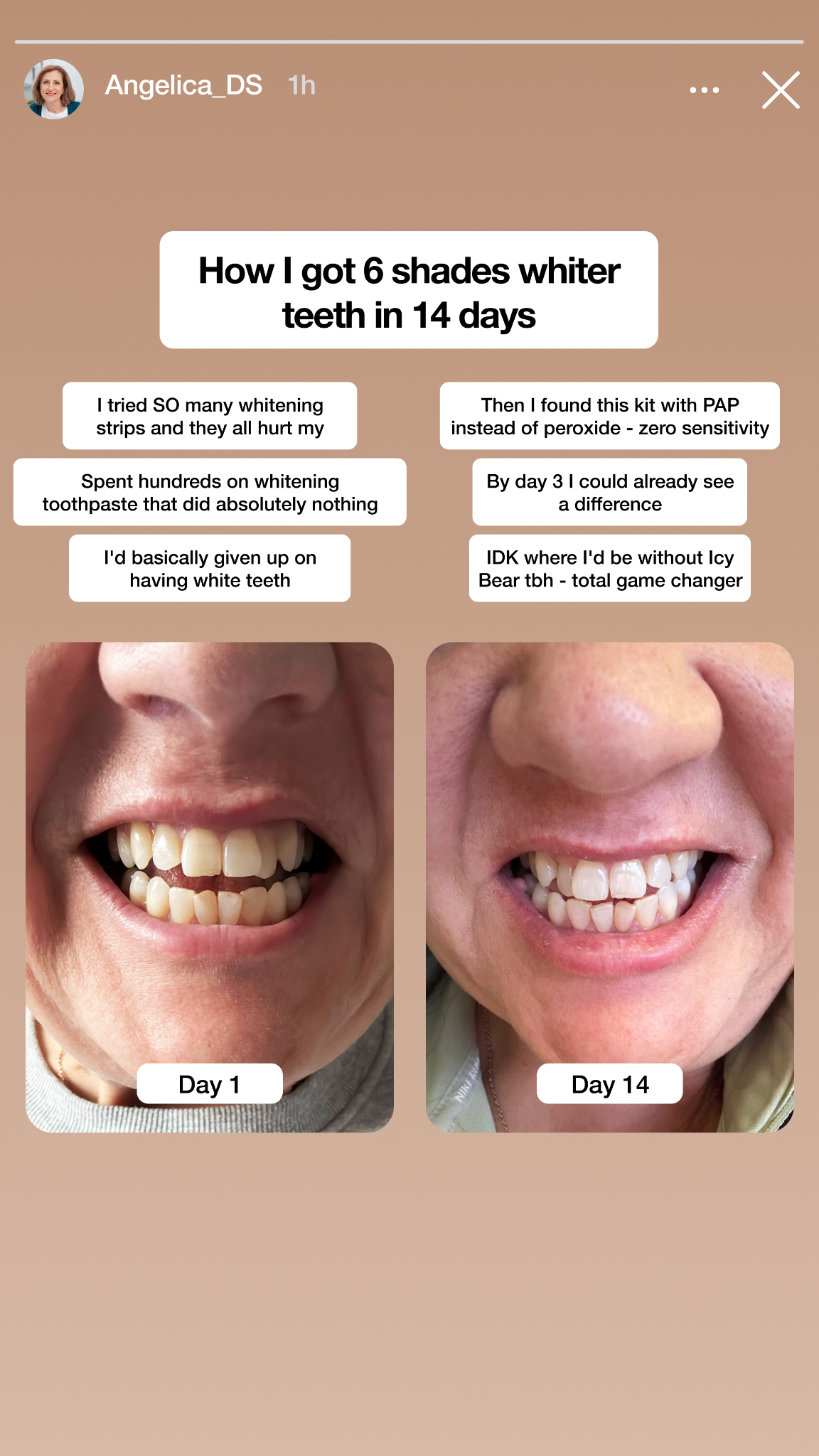 Icy Bear Dental Facebook ad
