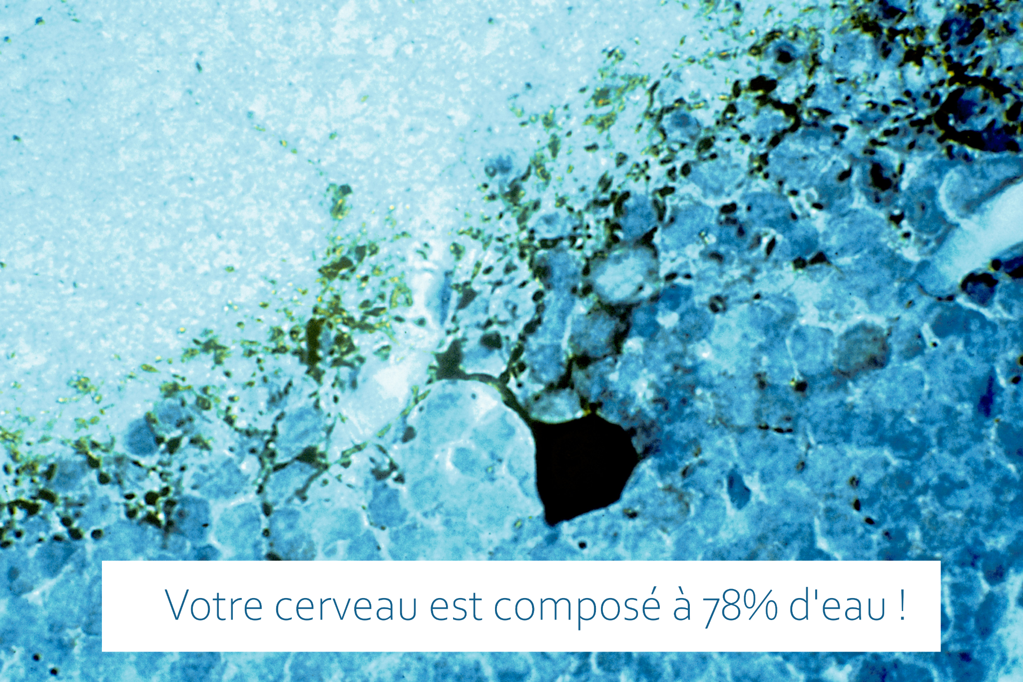 FRC - Neurodon Facebook ad: Les actus de la Fondation pour le Cerveau!