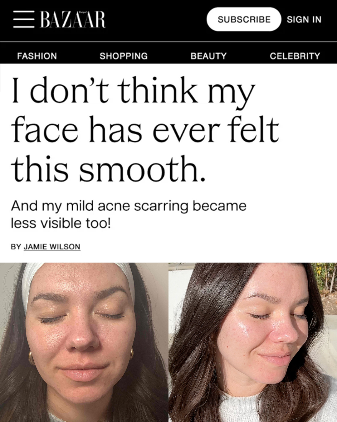 Skin Laundry Facebook ad