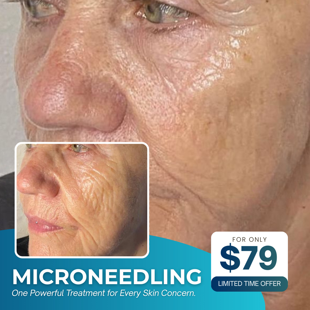 I Love Skin Treatments Facebook ad