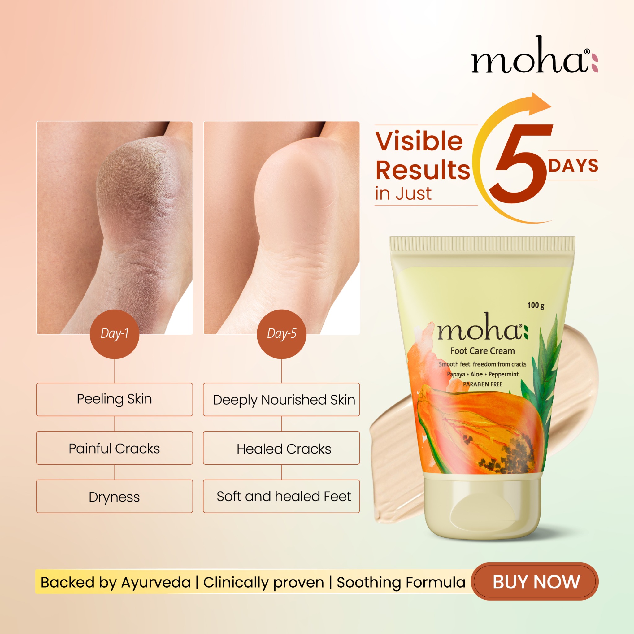 moha: Facebook ad