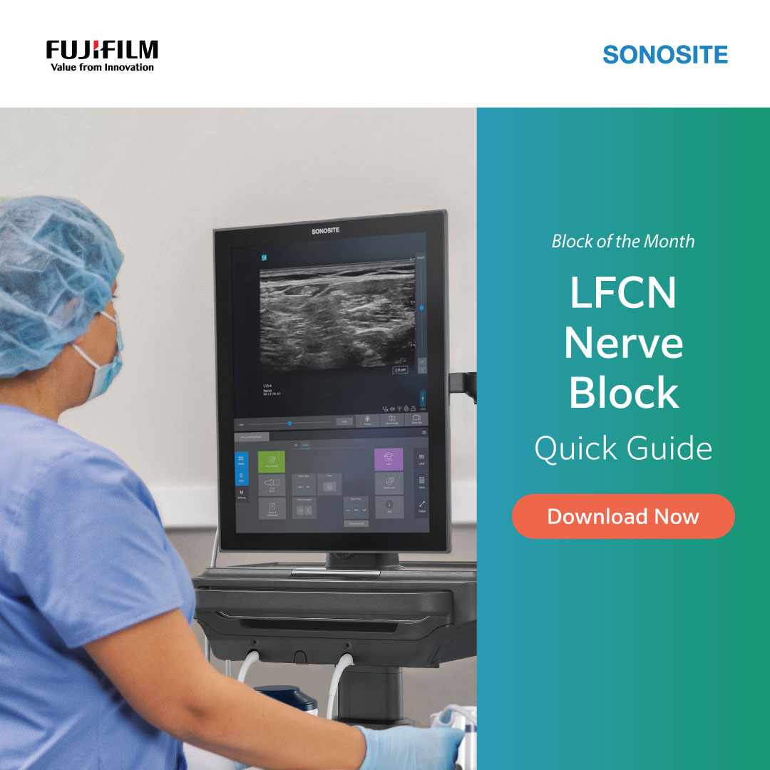 Fujifilm Sonosite Facebook ad