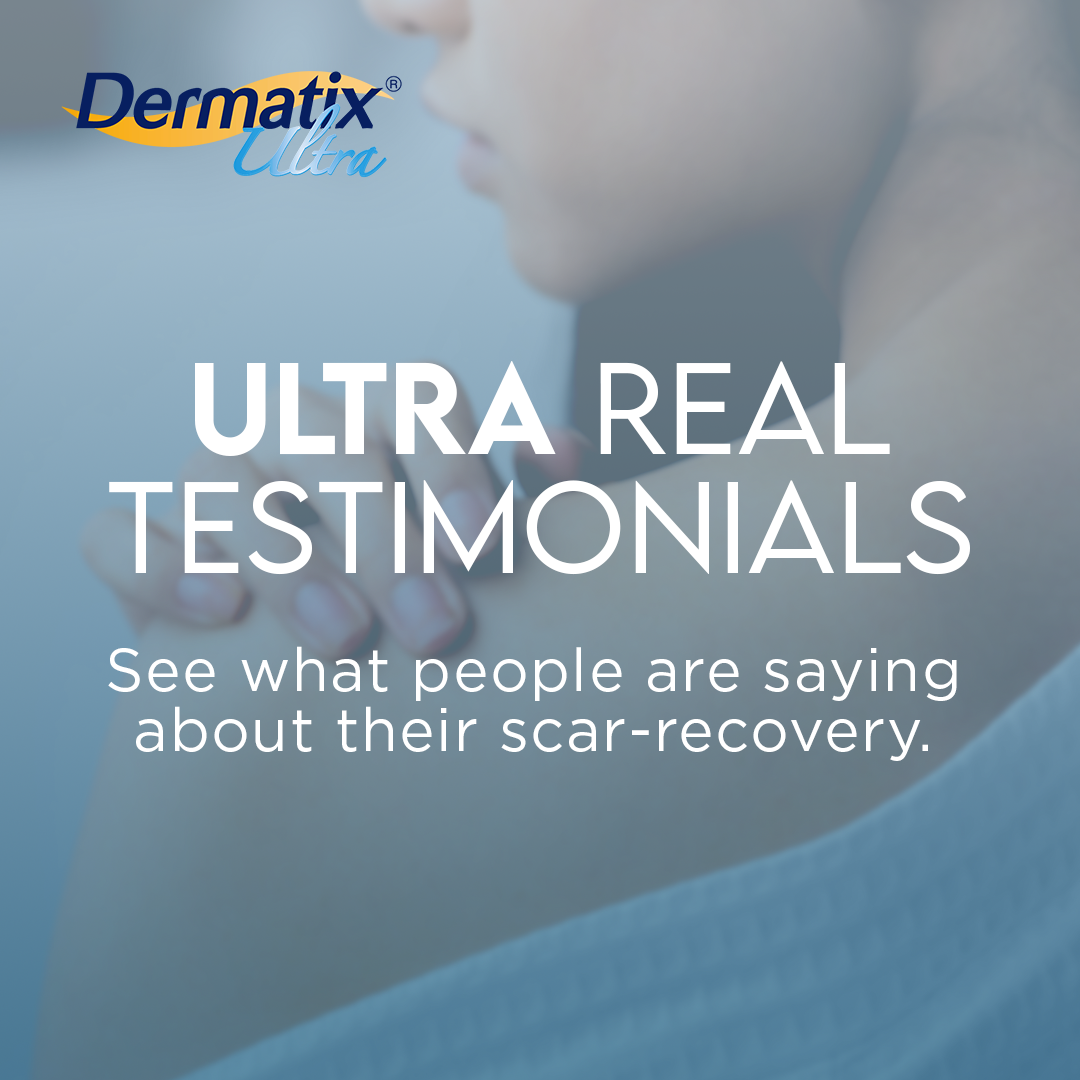 Dermatix Ultra Philippines Facebook ad: Ang scars mo?