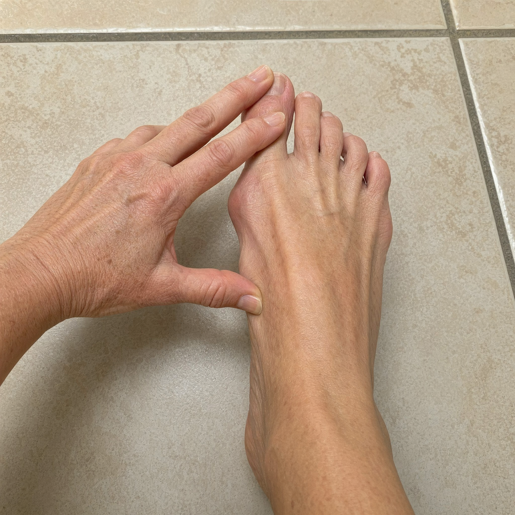 The Recovery Wire Facebook ad: Four podiatrists missed it for ten years