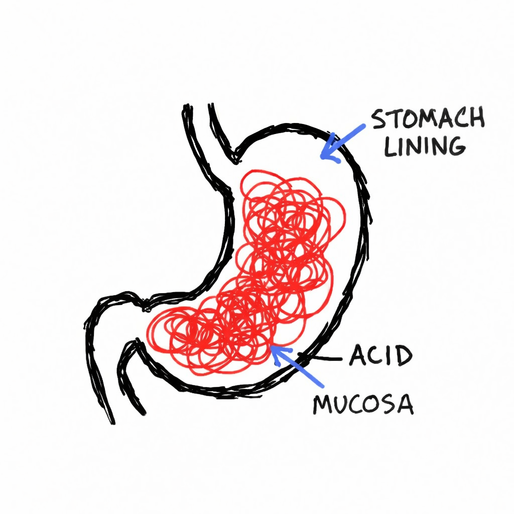 My Esophagus and Me Facebook ad