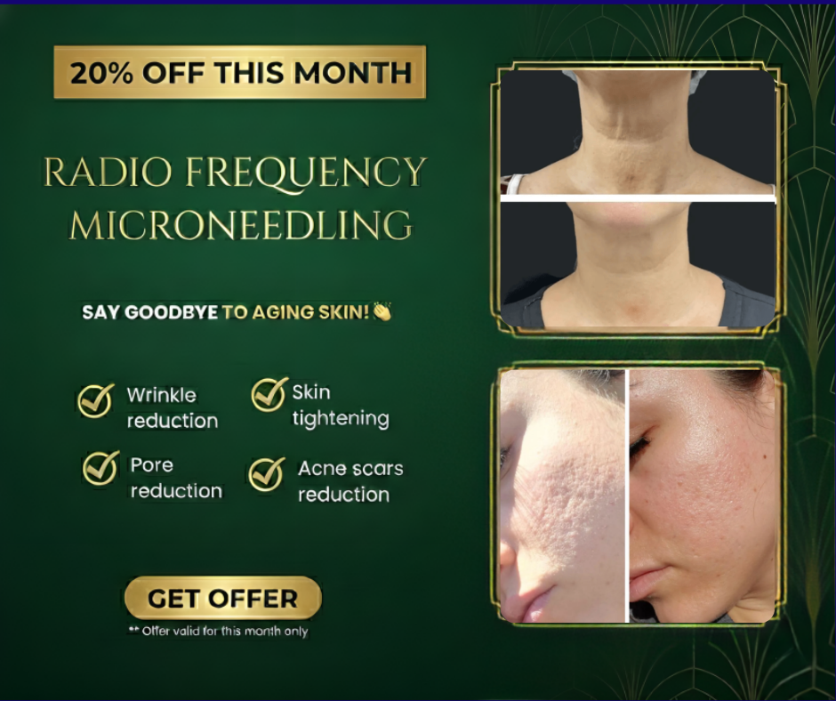 Fd aesthetics Facebook ad: 20% OFF Sylfirm X RF Microneedling