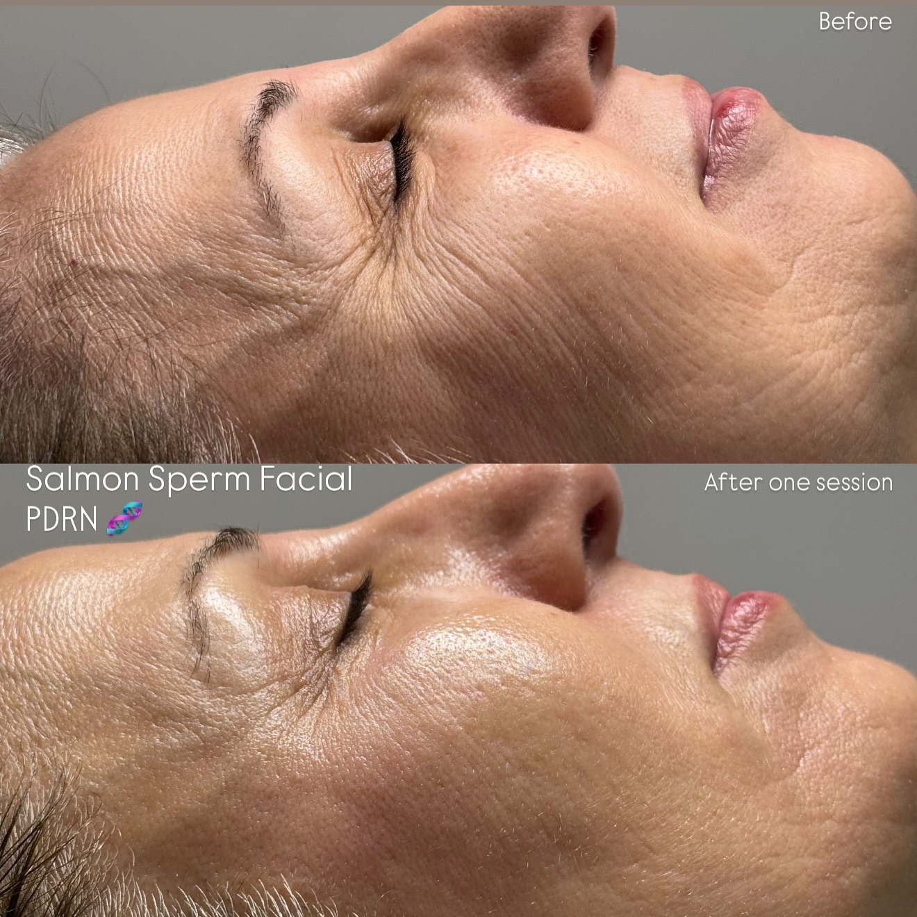 Skin And Laser Haus Facebook ad