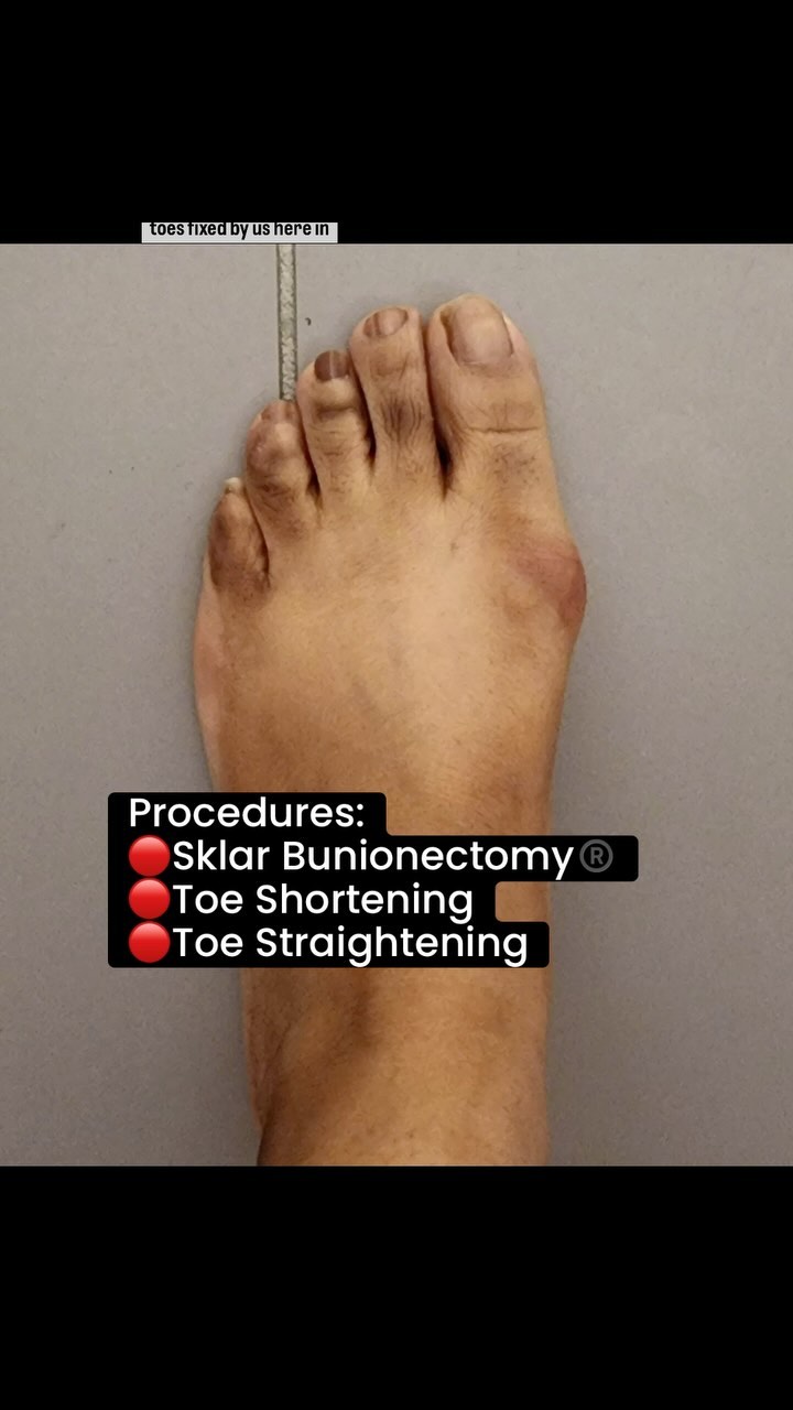 Foot First Podiatry Centers Facebook ad: Why don’t we do two in one day?