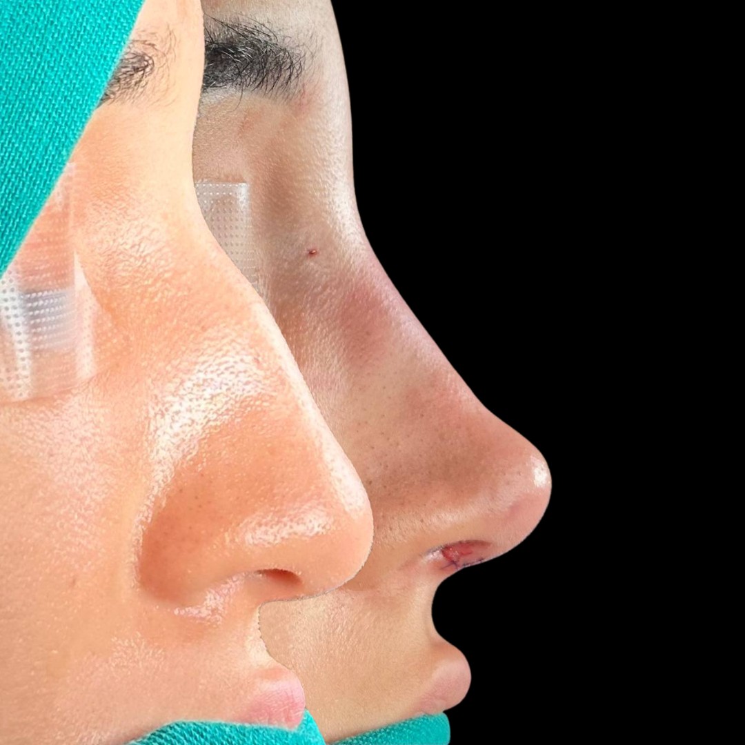 Doutor Gustavo Motta Facebook ad: Um detalhe que transforma a harmonia facial!