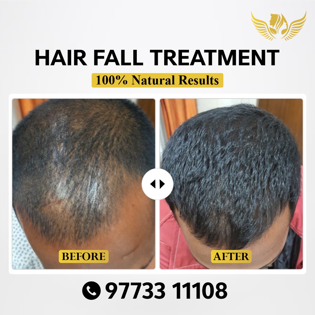 Skin Win - Skin, Laser & Hair Transplant Clinic Facebook ad