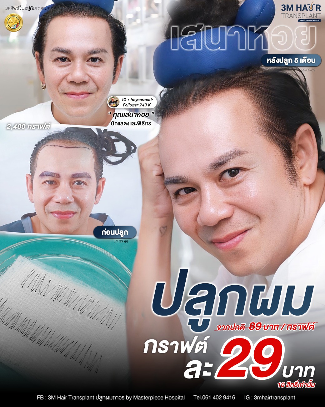 3M Hair Transplant ปลูกผมถาวร by Masterpiece Hospital Facebook ad