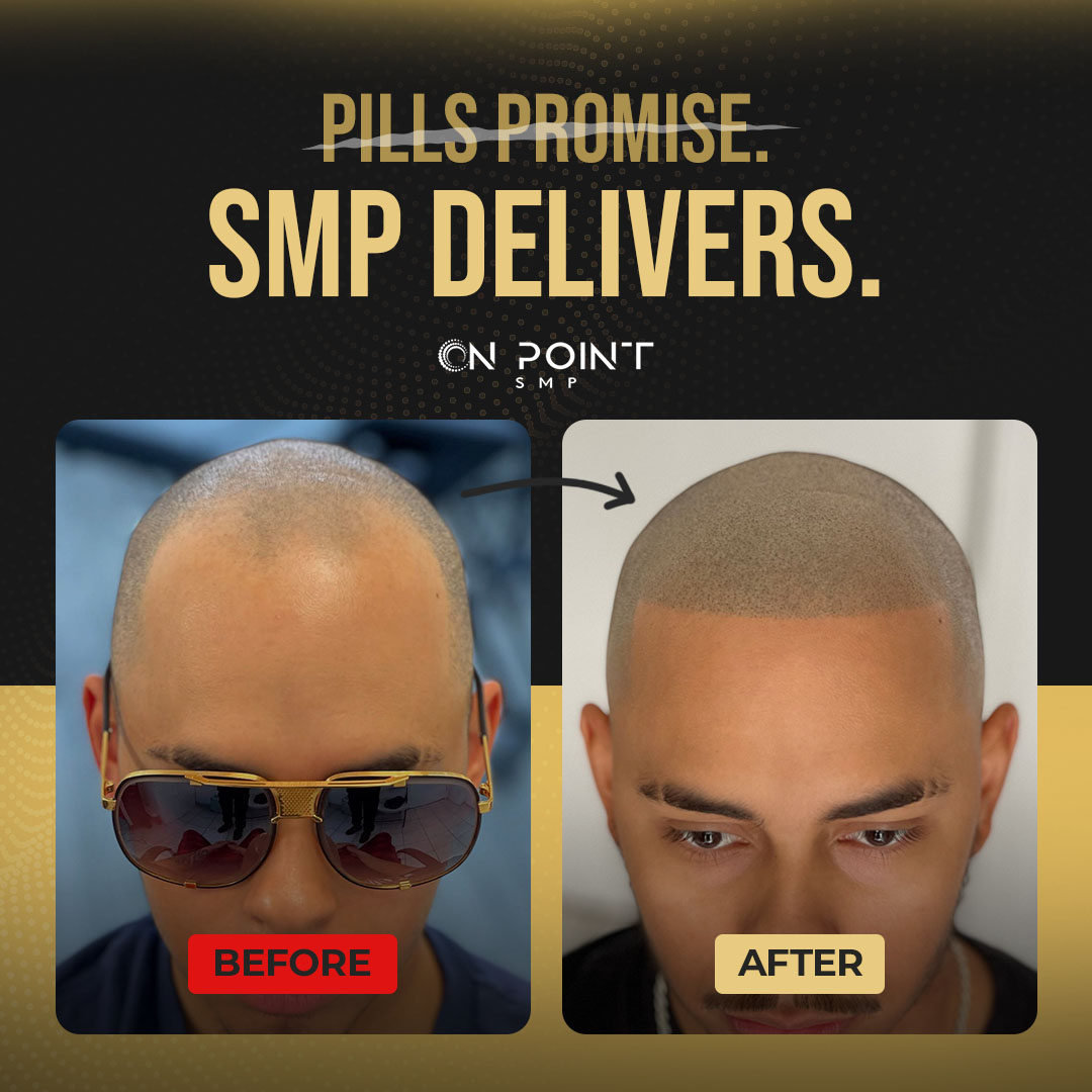 On Point SMP Facebook ad: California, 15% Off Scalp Micropigmentation