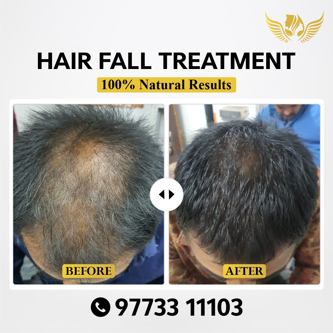 Skin Win - Skin, Laser & Hair Transplant Clinic Facebook ad