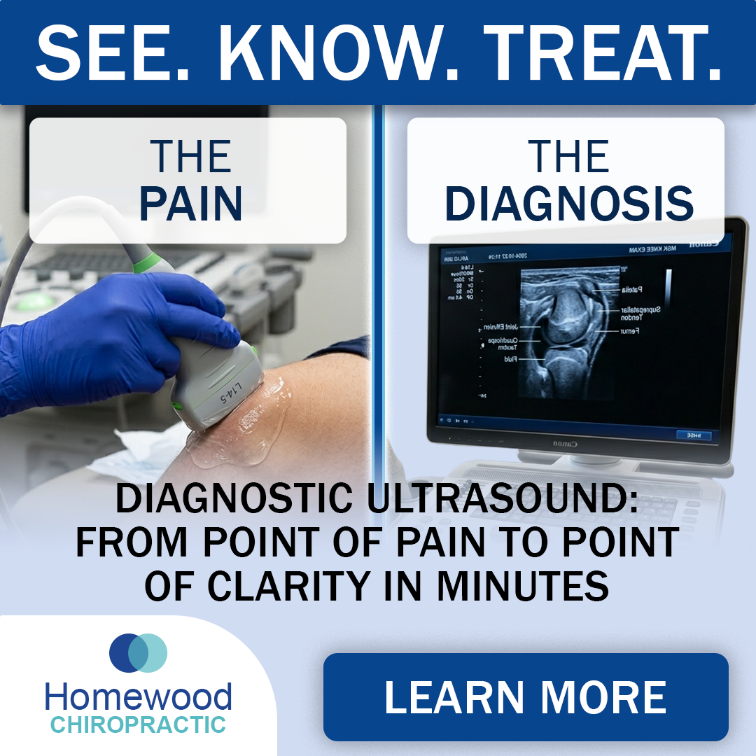 Homewood Chiropractic in Fareham Facebook ad from Jun 11, 2026