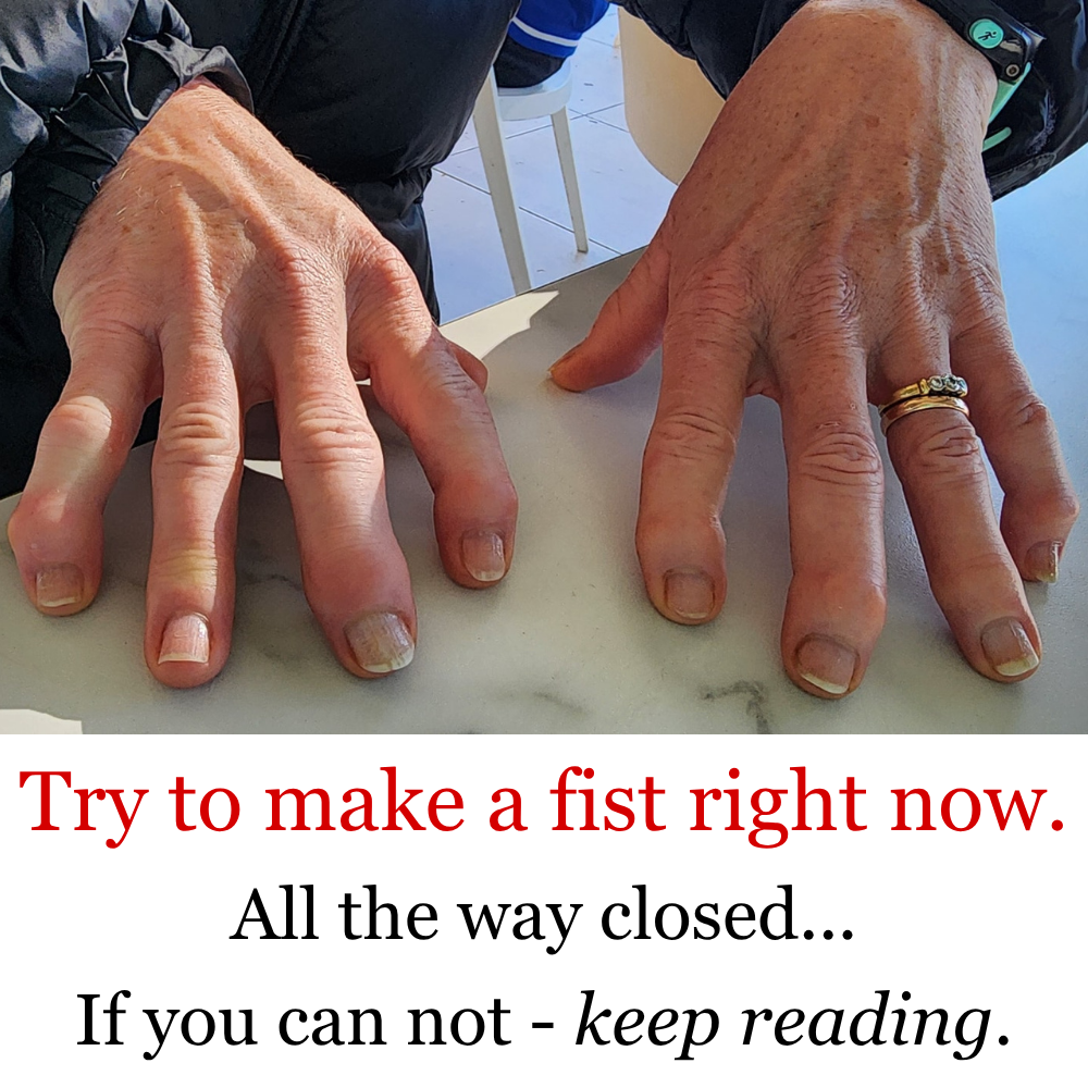 The Menopause Journal Facebook ad: Menopause did this to her hands