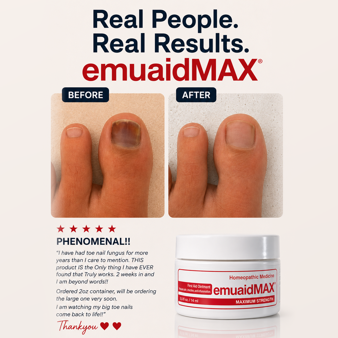 Emuaid Facebook ad: Doctor Recommended Formula