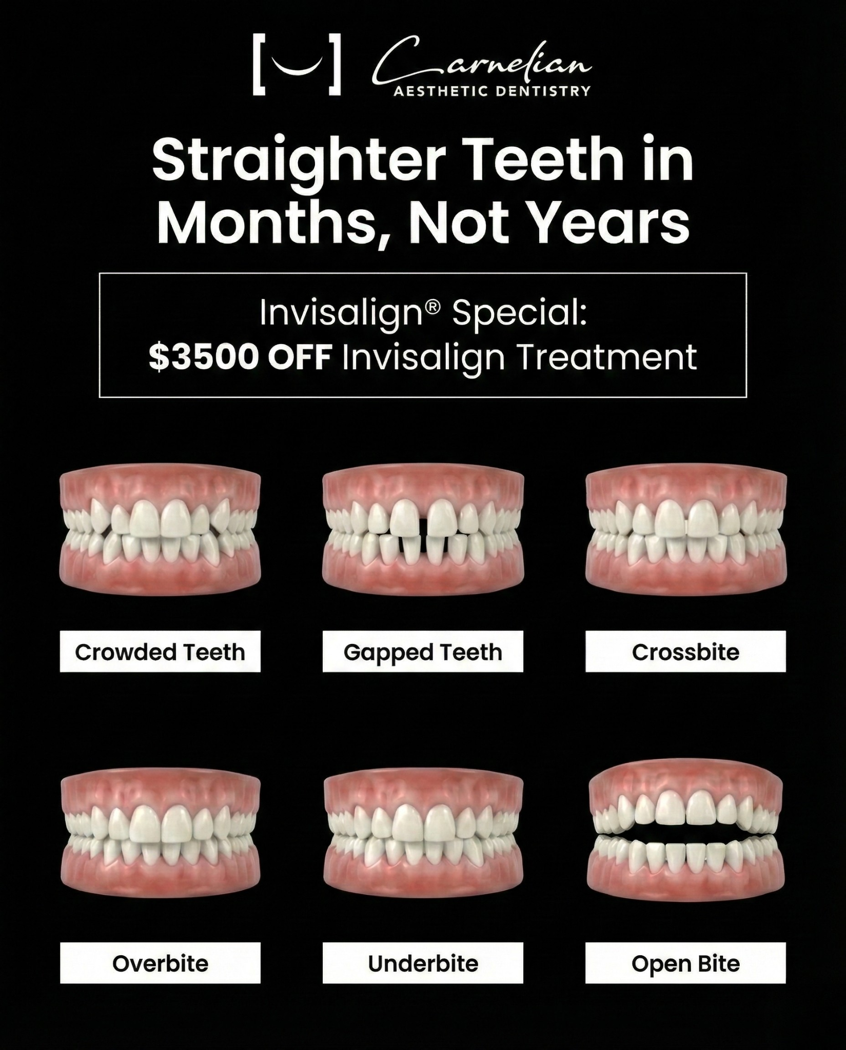 Carnelian Aesthetic Dentistry Facebook ad: Get $3500 OFF On Invisalign Treatment!