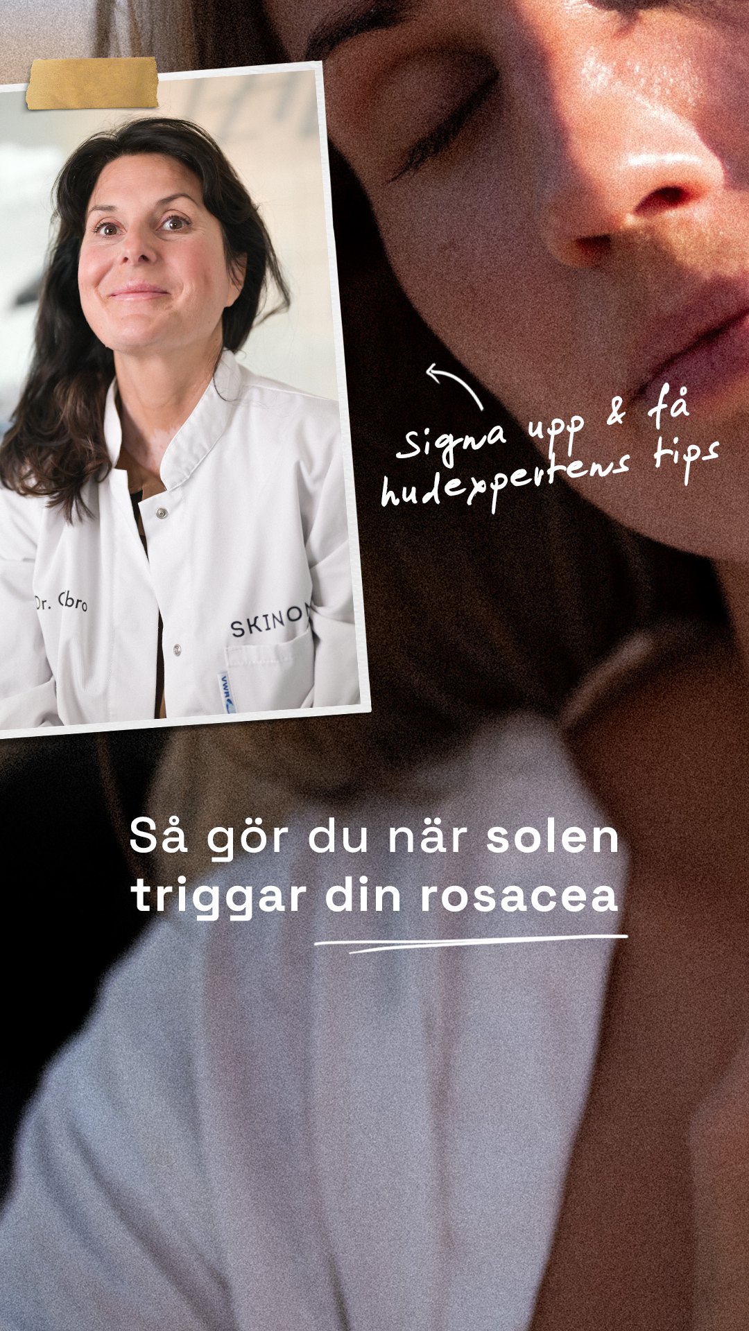 Skinome Facebook ad