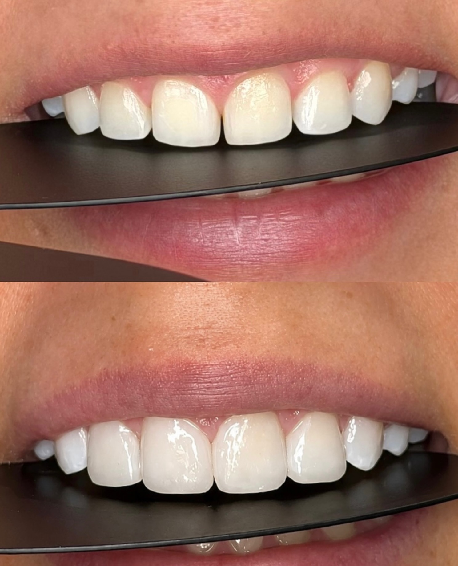 Elite Wellness and Dental Clinic Facebook ad: Small changes. Big difference.