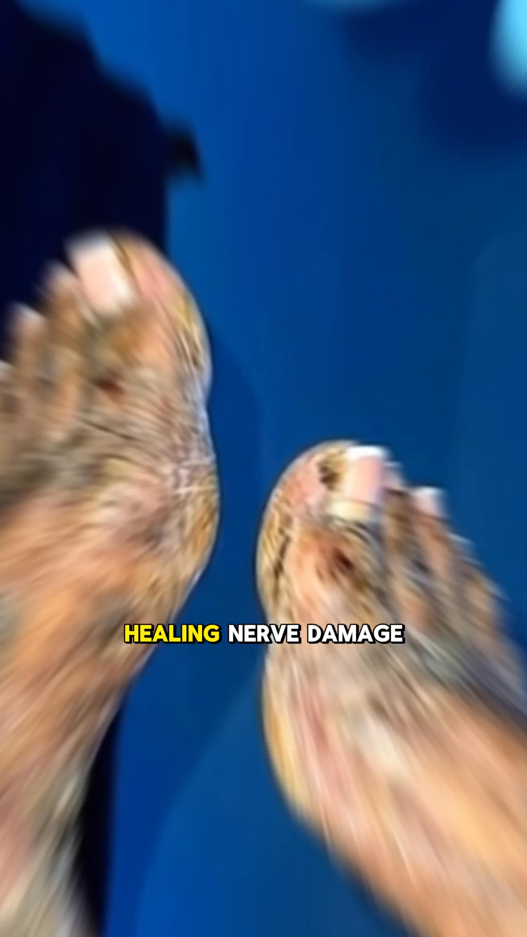 Senzio Facebook ad: There's Hope for Nerve Damage