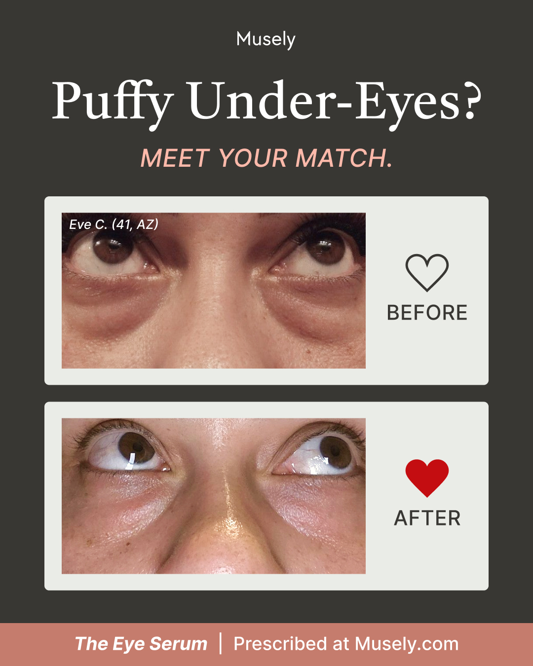 Musely Facebook ad