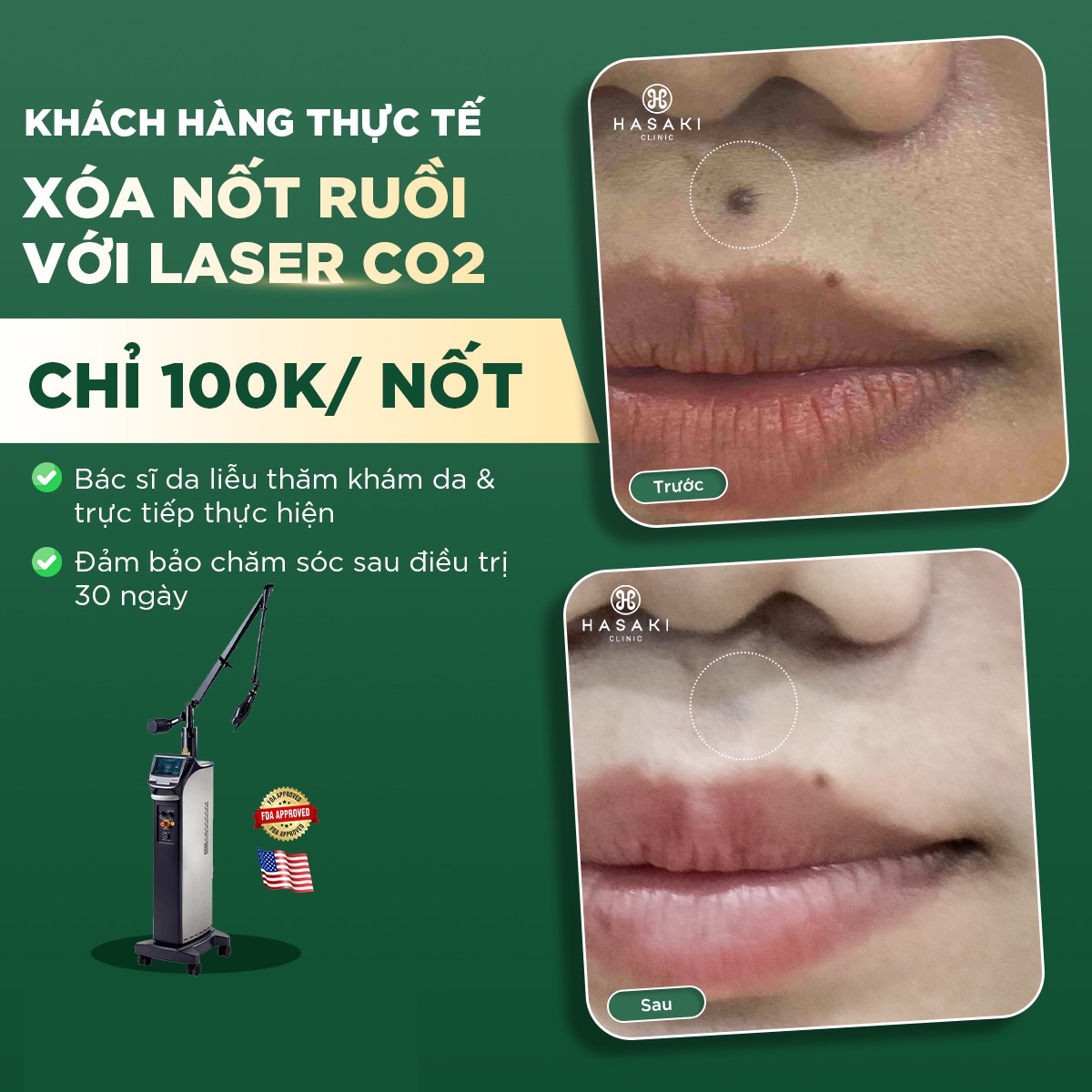 Hasaki Clinic Facebook ad