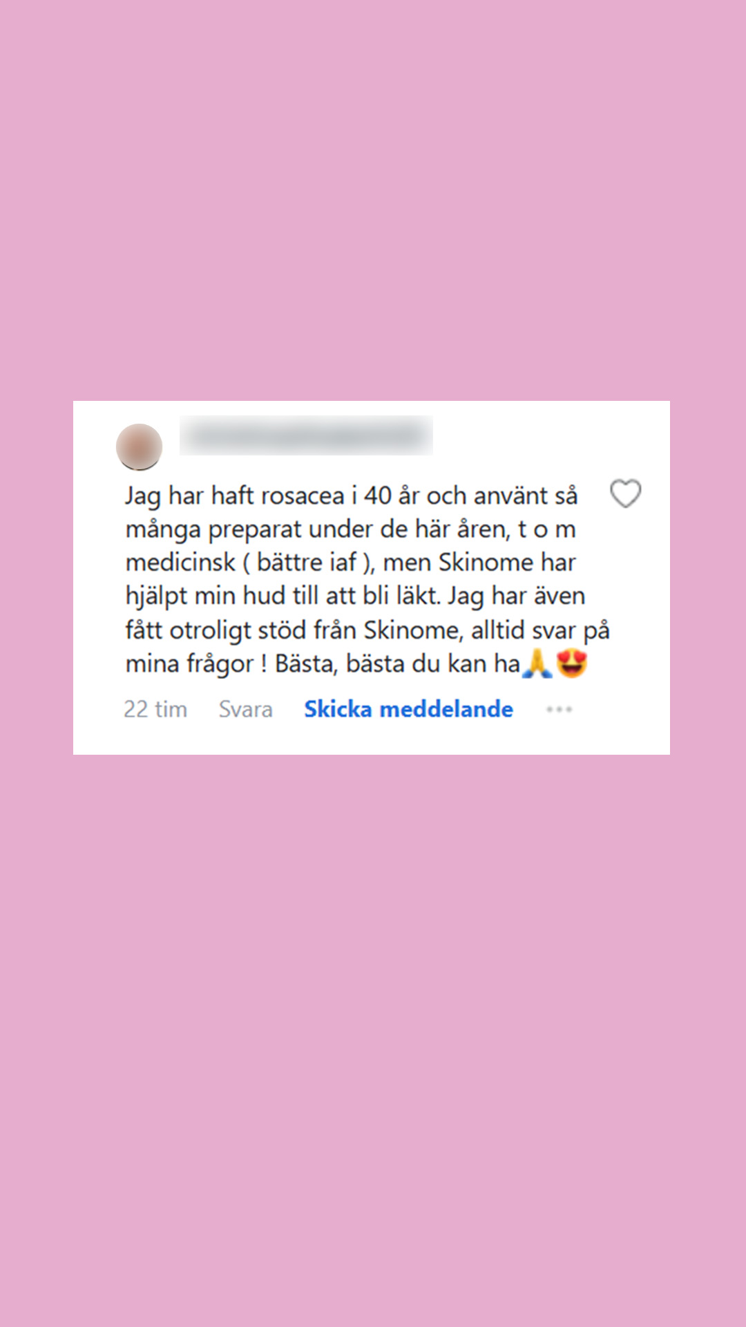 Skinome Facebook ad: Ge din hud det stöd den förtjänar