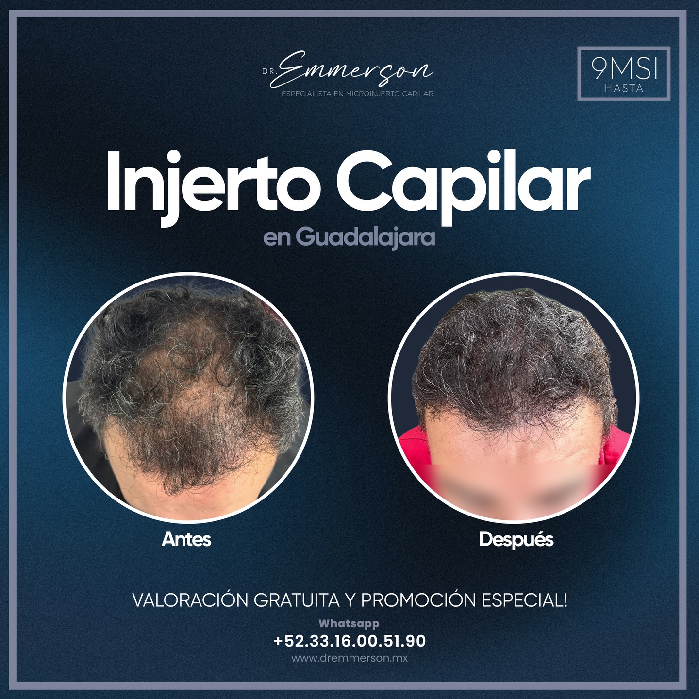 Dr. Emmerson Facebook ad: Me gusta que cada paciente entienda su caso…