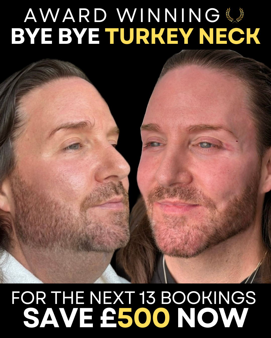Deep Aesthetics Facebook ad from Feb 14, 2026