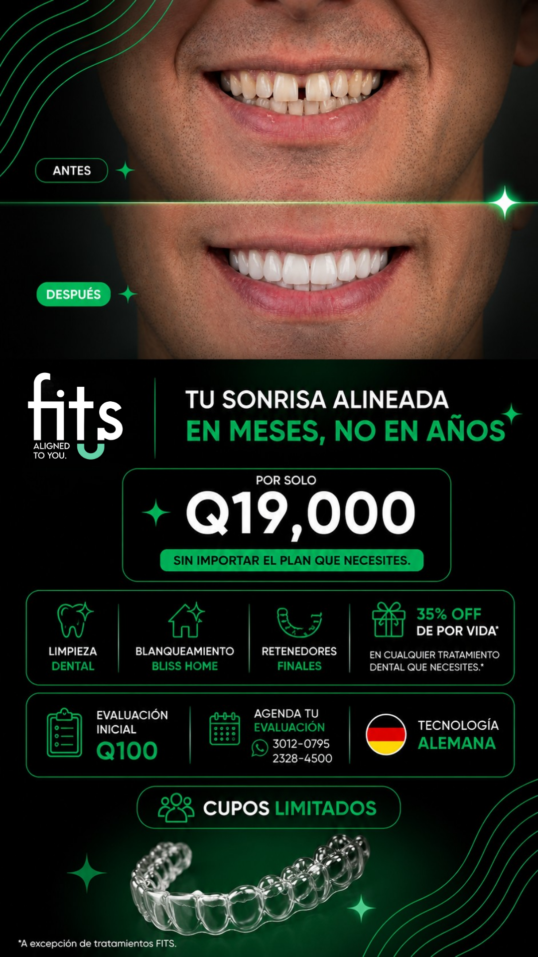 Fits Aligners Facebook ad