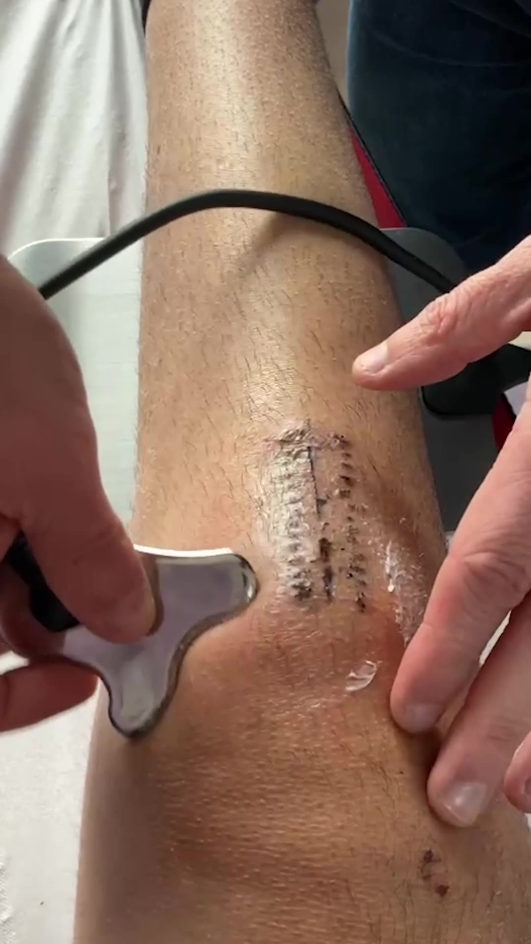 Winback Tecartherapy UK & Ireland Facebook ad: Elevate Manual Therapy with Winback