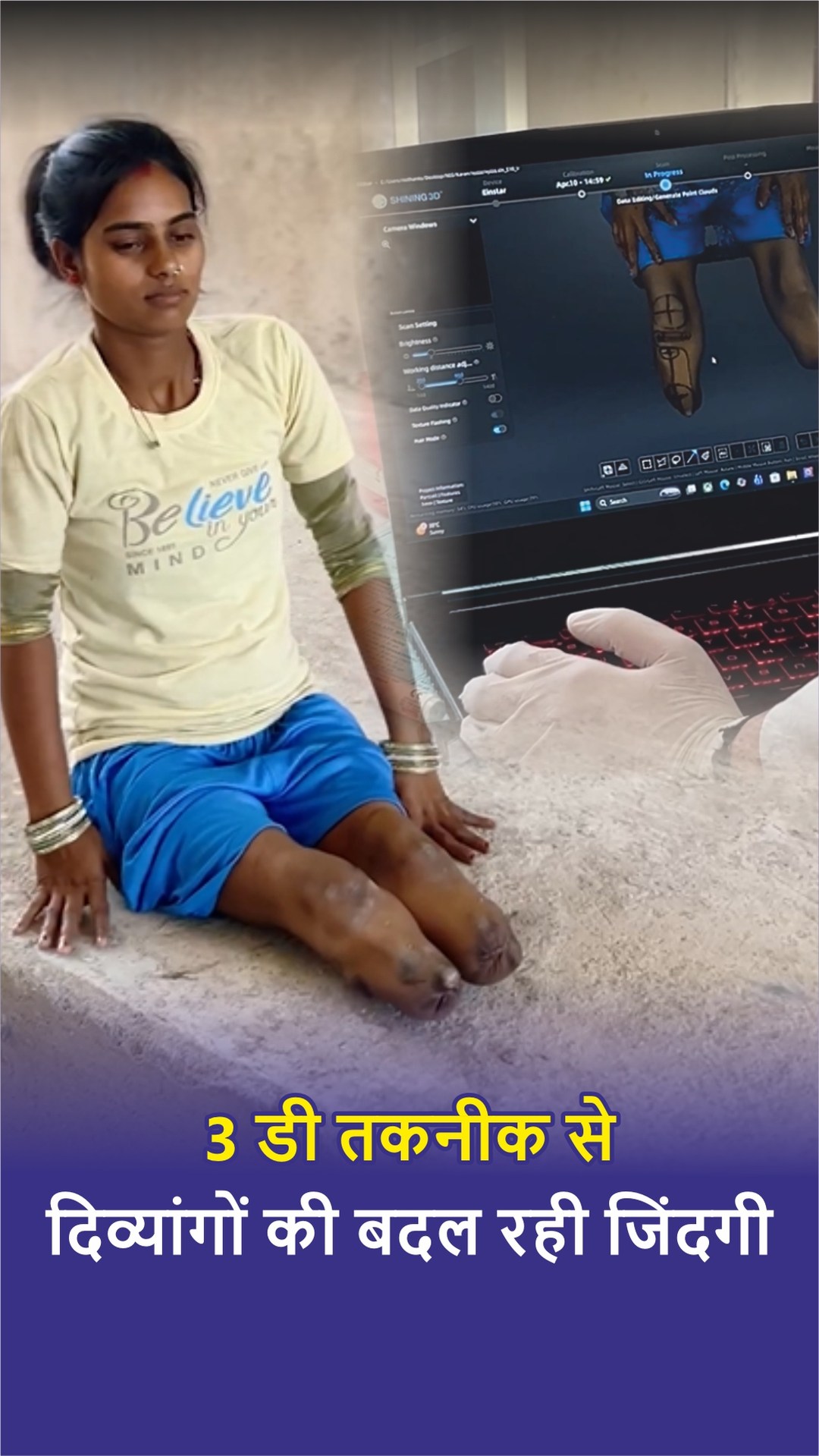 Narayan Seva Sansthan Facebook ad: नारायण सेवा संस्थान में उपचार के लिए आए…